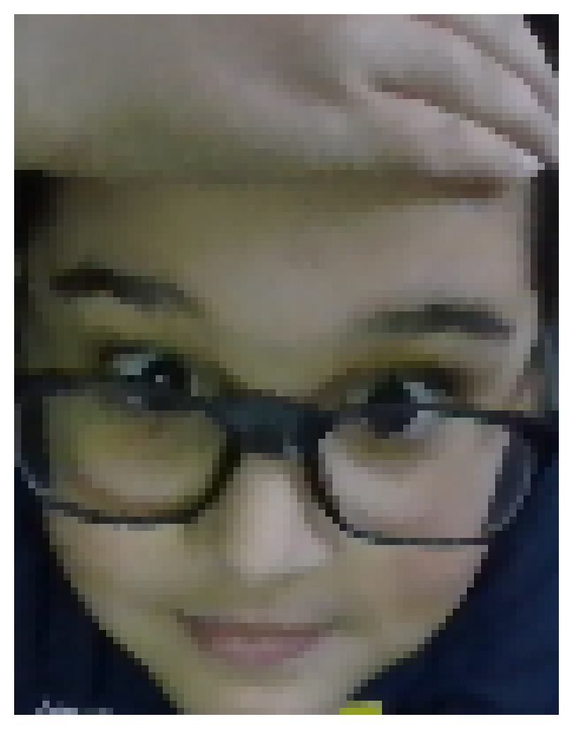 my big ass forehead
