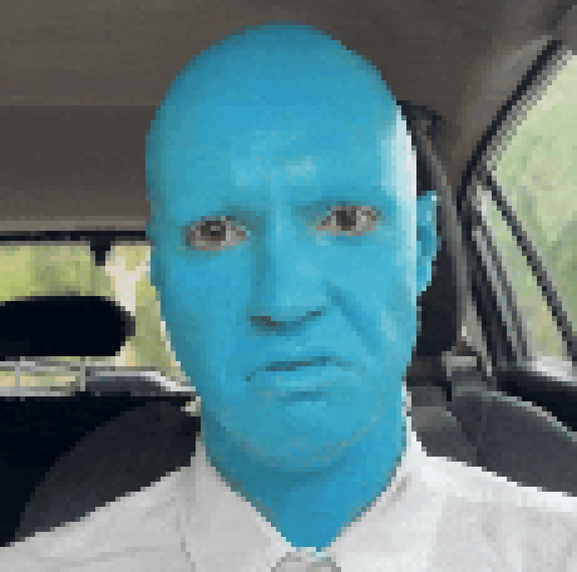 [8c660b] yes my genetic condition makes me blue