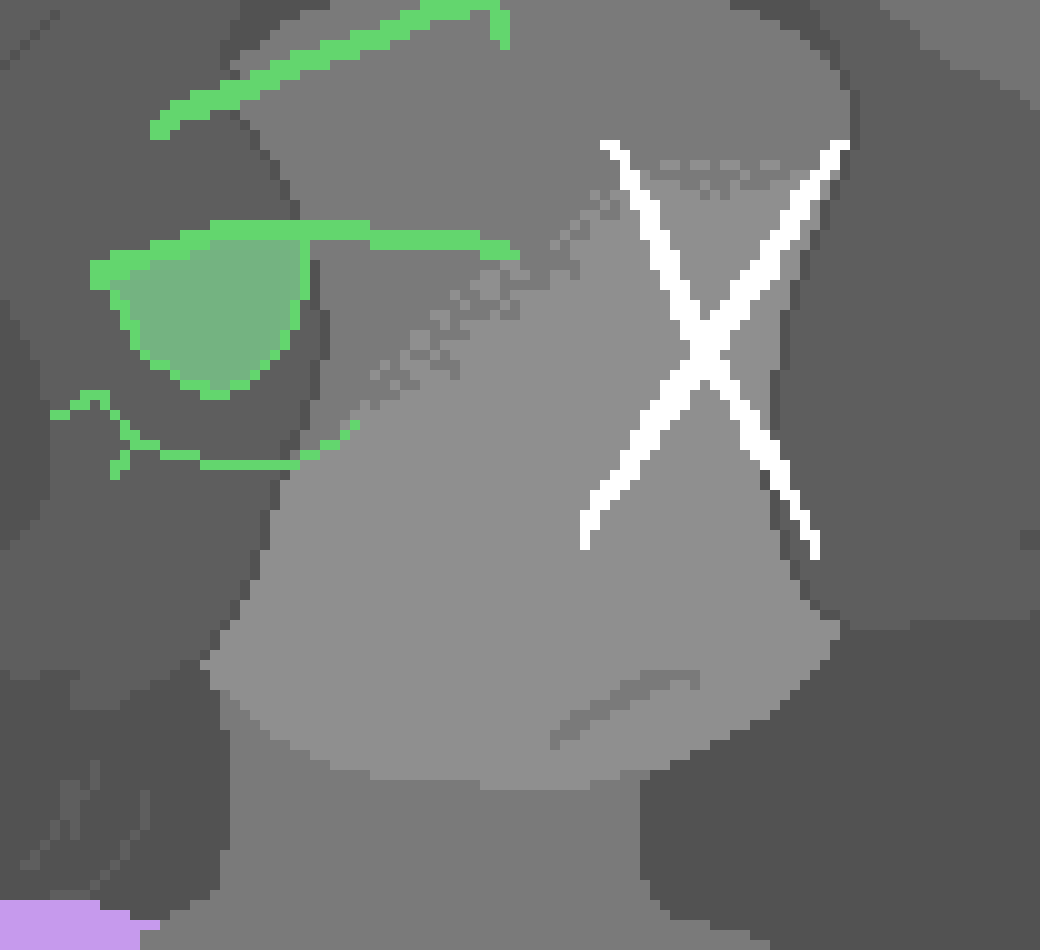 [1b5fa0] late but im hurt,  i  have this really bad  habit of clenching my  jaw  and it gives me  headaches, but  hbu