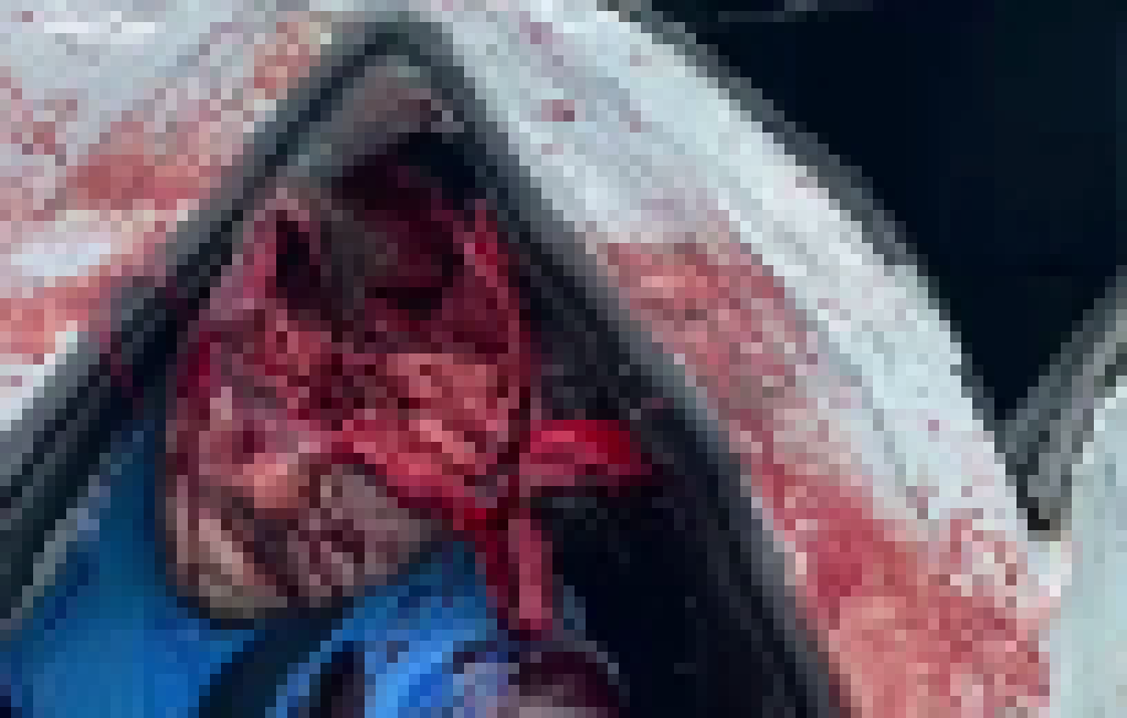 [e62dde] true art (ID change)