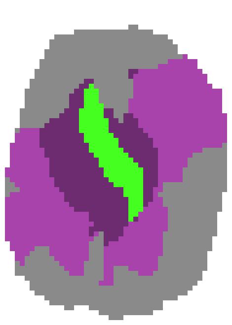 [9664c4] pure rad aerodactyl stone