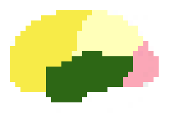 [b751a4] brain