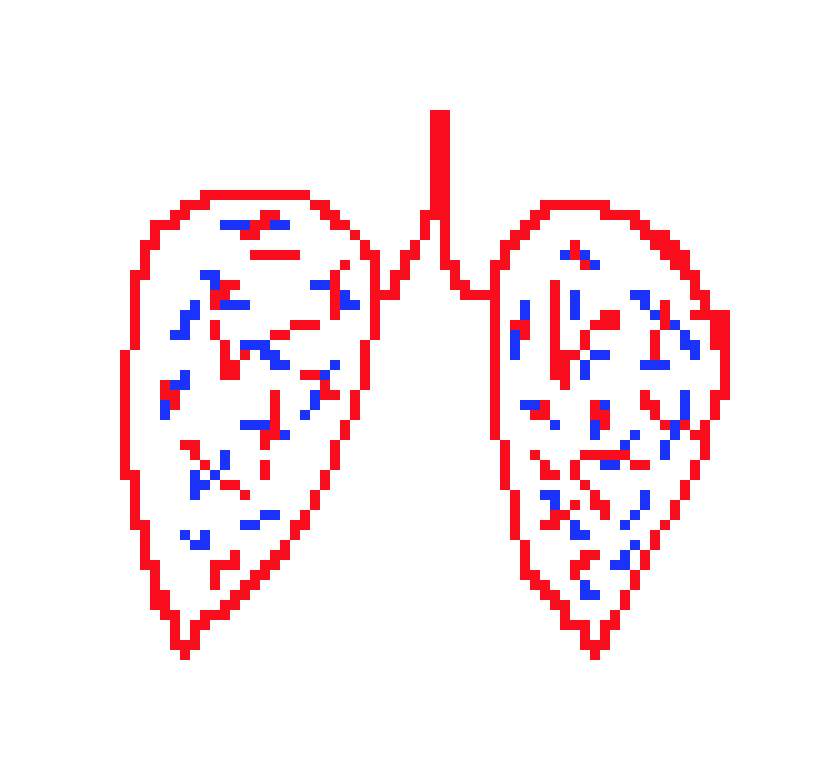 [a643a6] lungs