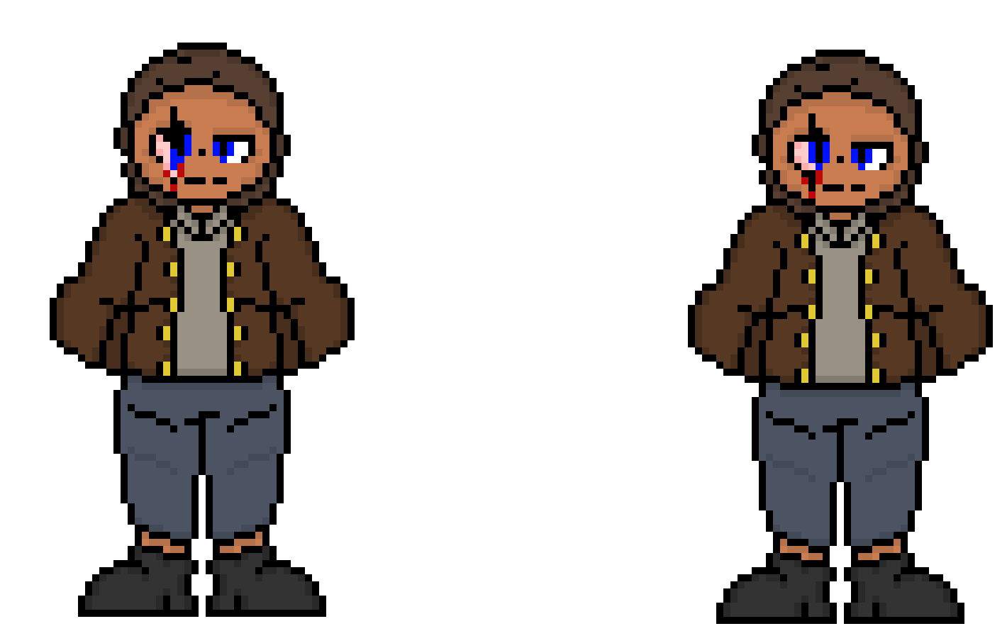 [57dac4] which eye injury looks better?