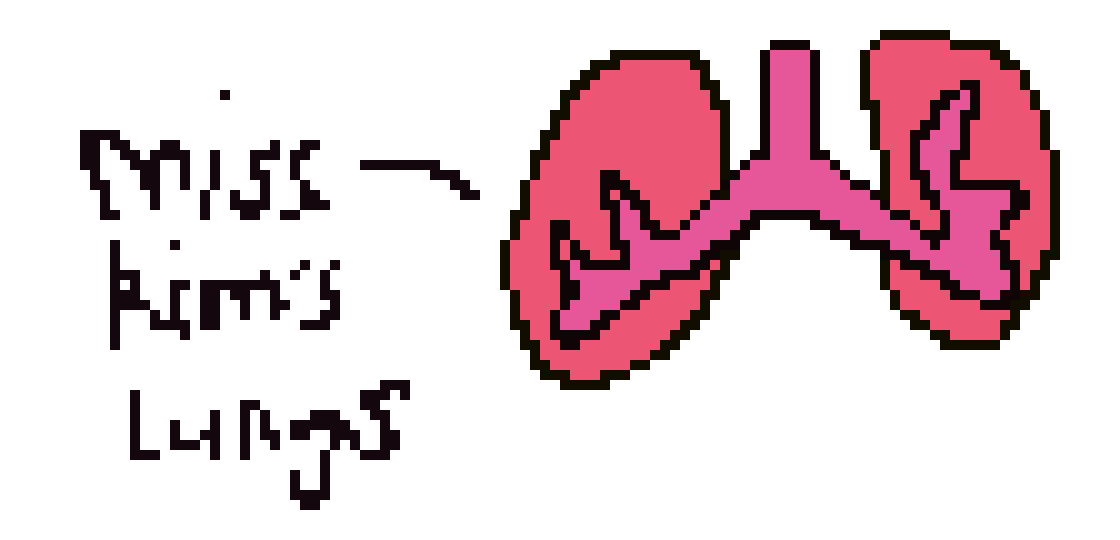 [2b4978] Miss Kim's lungs