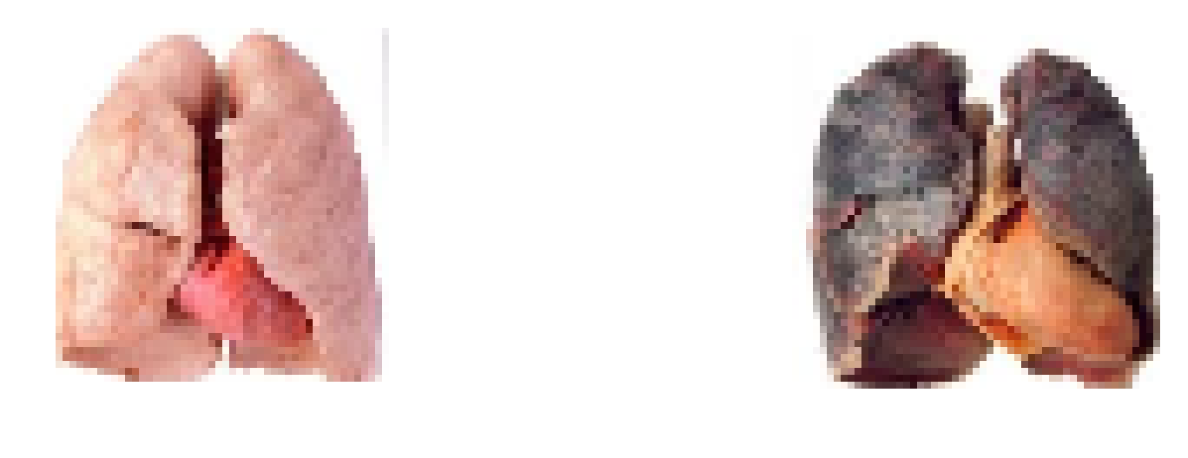 [6ee952] lungs before and after smoking