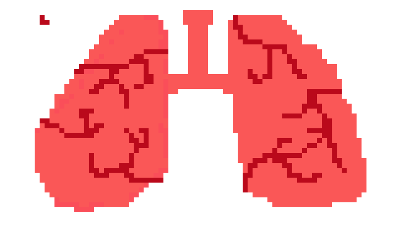 [3991ac] lungs