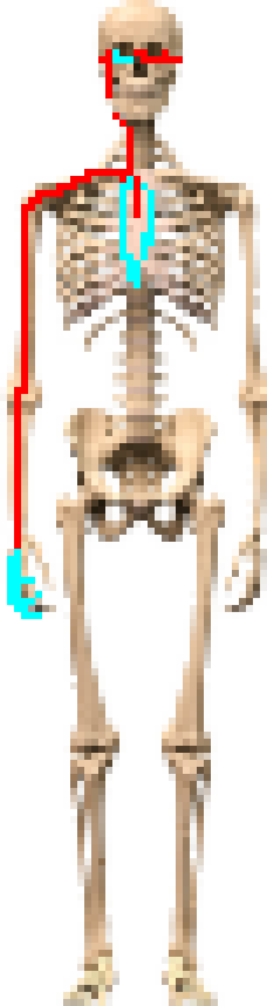 [65a21e] what