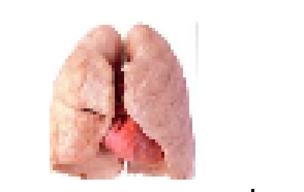 [6ee952] lungs before and after smoking