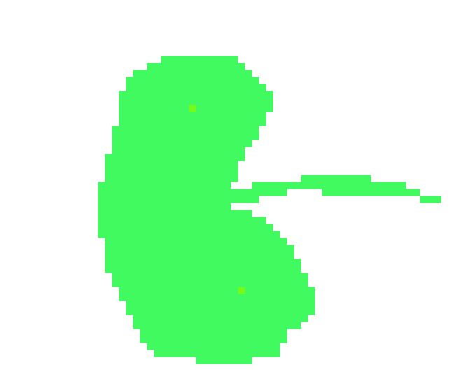 [2b4978] Lymph Node