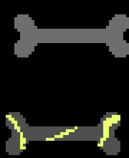 [e5153b] Nega bone phase 1 and 2