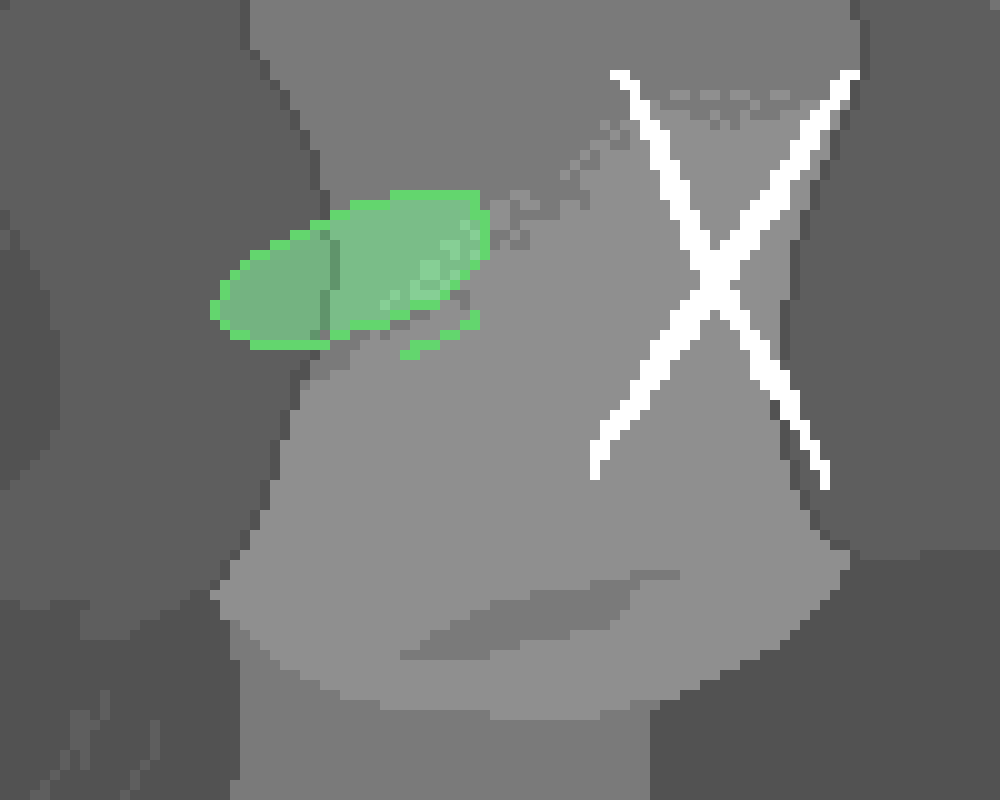 [dfd87c] uhm