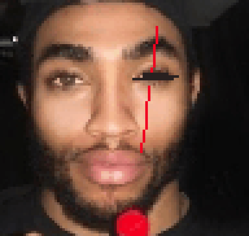 [497c85] still profusely bleeding from eye