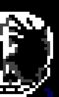 [c7b058] don't you love when your eye explodes