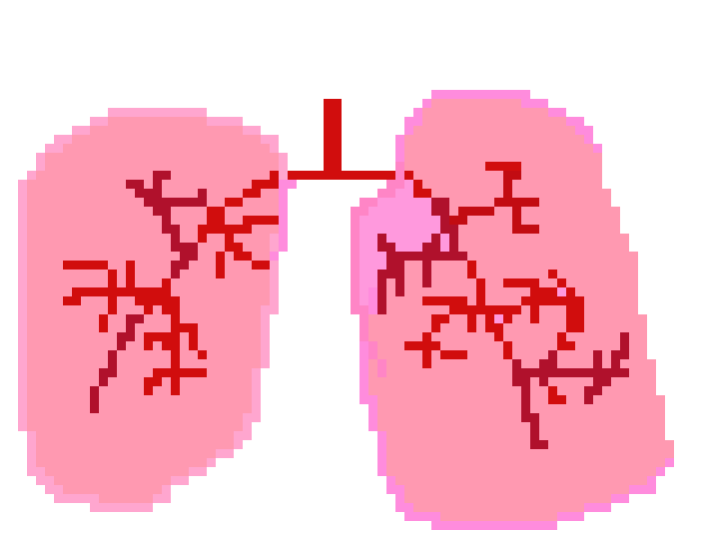 [401978] Pixel lungs
