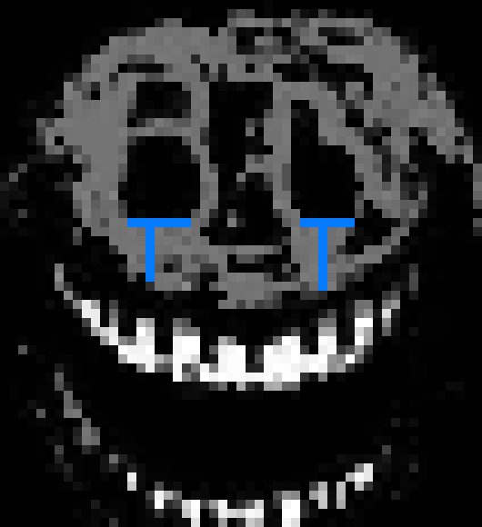 [b63bdb] NO AMBUSH!