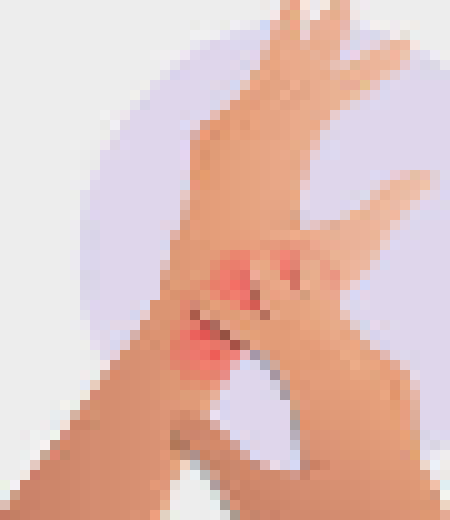 [224a35] itches