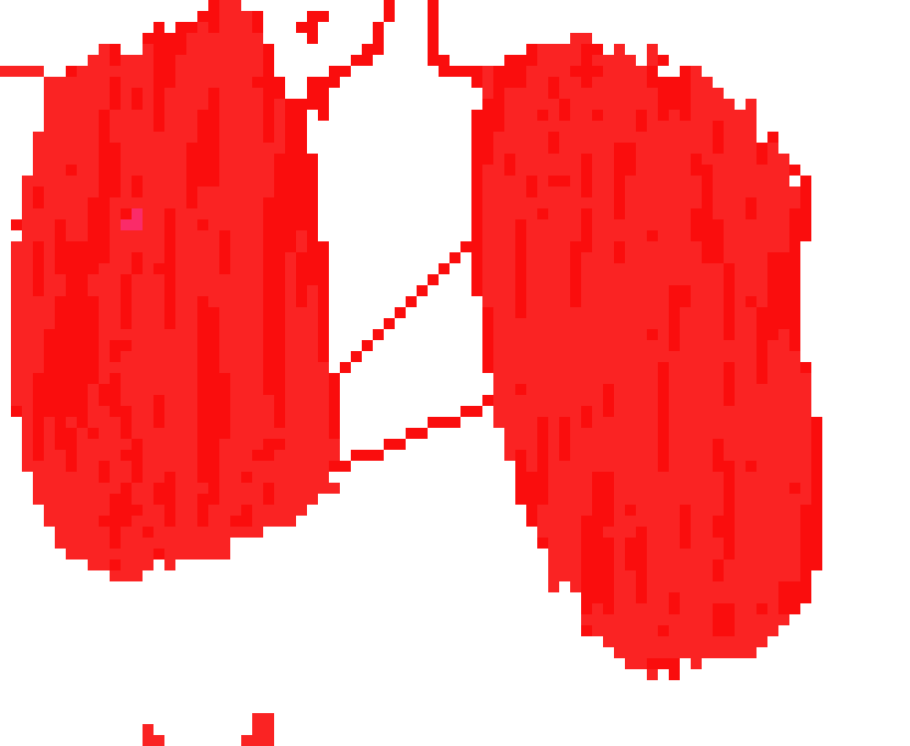 [2b4978] Lung draweding